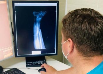 Челнинские травматологи пришили мужчине почти оторвавшуюся стопу