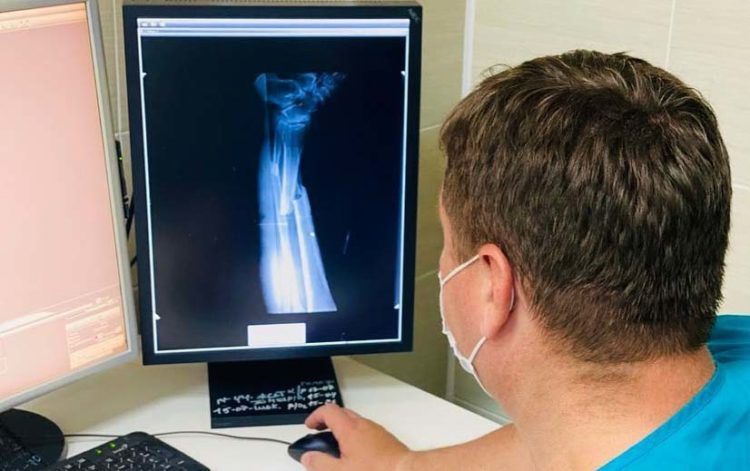 Челнинские травматологи пришили мужчине почти оторвавшуюся стопу