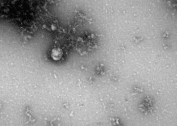 Российские ученые сделали первое в мире фото «британского» штамма коронавируса