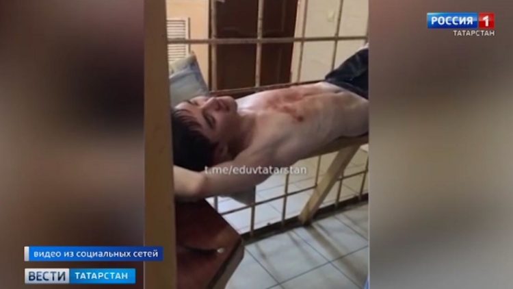 «Повезло, что учитель вышел и закрыл дверь»: за жизнь пострадавших школьников борются врачи ДРКБ