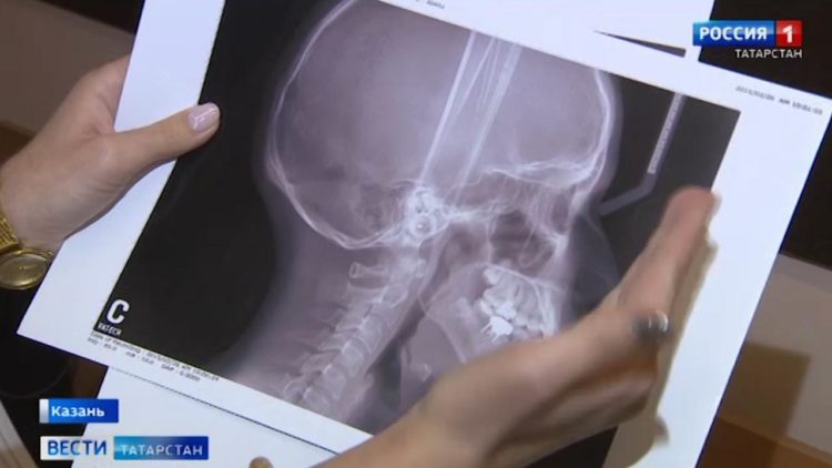 В Казани суд оправдал врача, которого обвиняли в некачественной установке брекетов