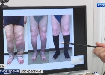 Врачи РКБ рассказали, как спасают беременных с коронавирусом