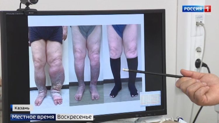 Врачи РКБ рассказали, как спасают беременных с коронавирусом