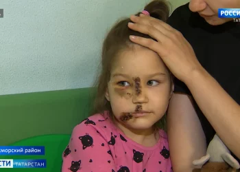 «У психолога побудут»: Искусавшая детей собака в Кукморском районе оказалась бешеной