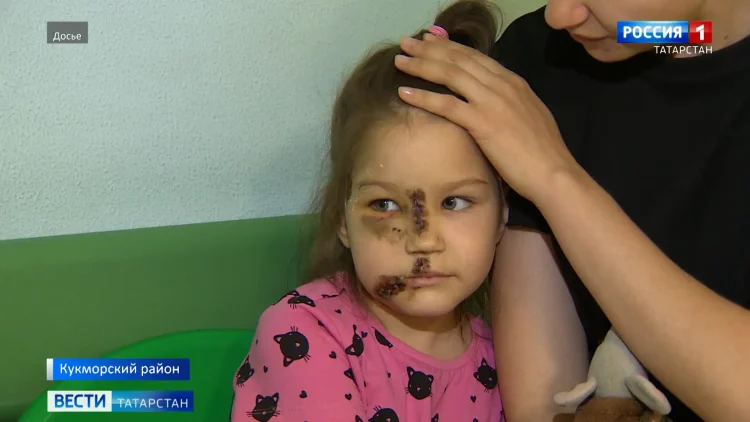 «У психолога побудут»: Искусавшая детей собака в Кукморском районе оказалась бешеной