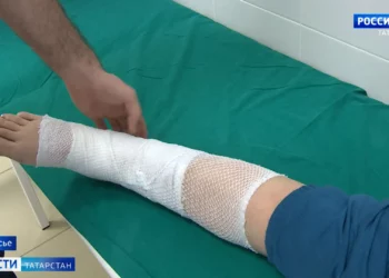 В Казани на ноги пассажирки автобуса вытек раскаленный антифриз