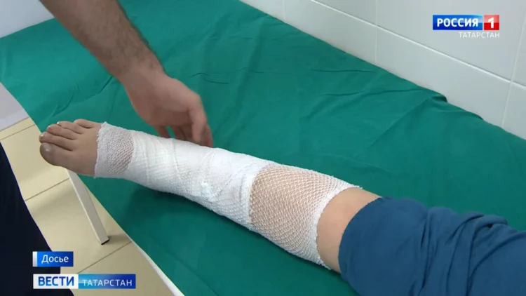 В Казани на ноги пассажирки автобуса вытек раскаленный антифриз