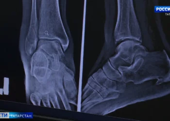 Осторожно, гололед: в травматологиях Татарстана наблюдается наплыв пациентов