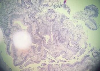 В онкодиспансере Челнов показали, как выглядят раковые клетки