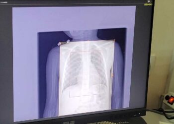 В городской больнице №2 Чистопольской ЦРБ провели более 2 тысяч исследований на ренгент-аппарате, установленного по нацпроекту