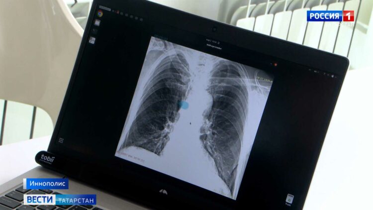 Нейросеть может помочь врачам определять патологии