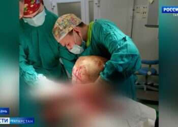 Хирурги РКБ за раз удалили у женщины камни, грыжу и кисту весом 20 кг