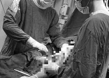 В Казани врачи прооперировали мужчину со сложным переломом после падения с самоката