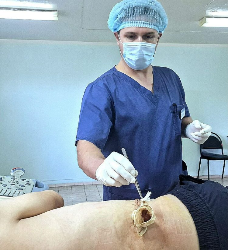 Урологи спасли жителя Челнов, который упал с велосипеда и разорвал почку