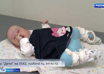 Саша Субботина с редким заболеванием «артрогрипоз» нуждается в вашей помощи