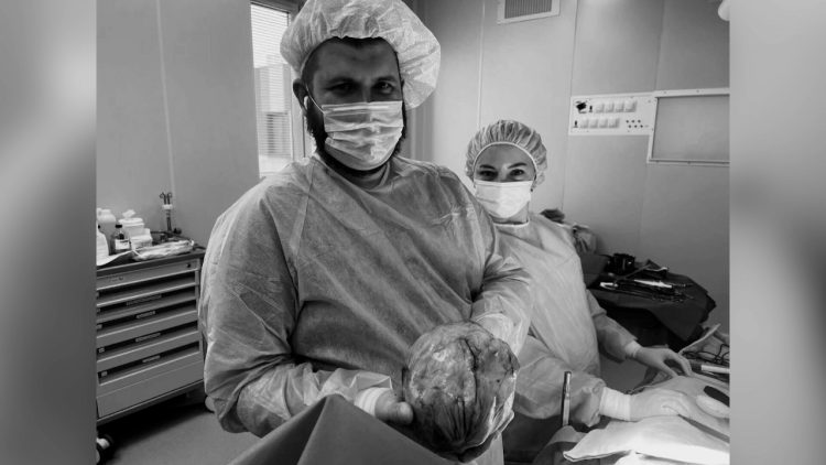 Медики из Челнов спасли пациентку, вырезав ей одновременно три опухоли