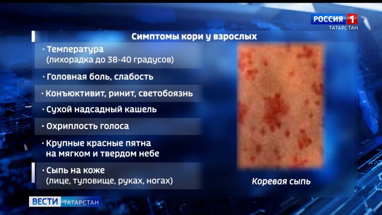 Вспышка кори в Казани и Зеленодольском районе: жителям настоятельно рекомендуют вакцинироваться