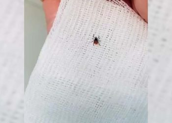 В Нижнекамске 51 человек обратился за помощью в травмпункт после укуса клещей