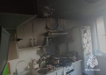 В Челнах девушка получила сильные ожоги на пожаре