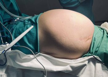 В РКБ удалили семикилограммовую опухоль