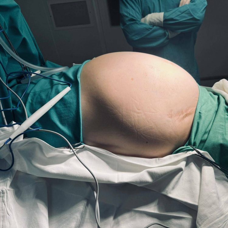 В РКБ удалили семикилограммовую опухоль